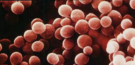 Staphylococcus aureus Προκαλεί πυρετογόνες μολύνσεις (εξανθήματα κλπ.