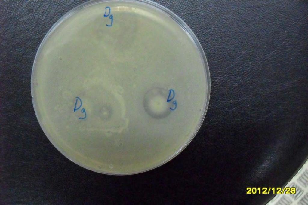 Εικόνα 2: ζώνες αναστολής για το Staph.aureus της αποικίας Ε4 που ανήκει στο δείγμα μελιού 30