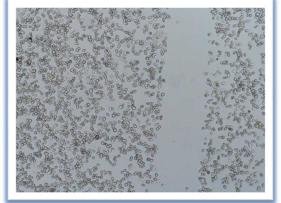 mir-treated κύτταρα (8h) Control κύτταρα (8h) Εικόνα 31: Πολλαπλασιασμός