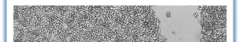 mir-treated κύτταρα (24h) Control κύτταρα (24h) Εικόνα 32: Πολλαπλασιασμός και μετανάστευση των HepG2 κυττάρων