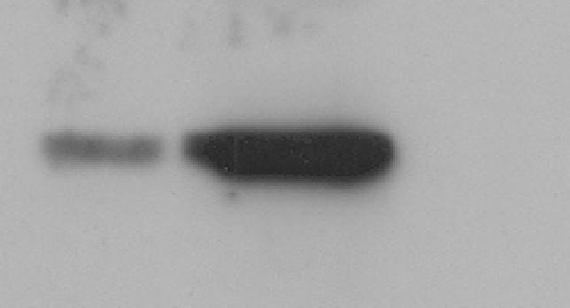 Επίπεδα έκφρασης HNF-4α Spheroids HepG2 Επίπεδα έκφρασης p-65 Spheroids HepG2 Εικόνα 38: Ανάλυση κατά Western των επιπέδων έκφρασης του HNF-4α σε κυτταρικά εκχυλίσματα καρκινικών στελεχιαίων κυττάρων