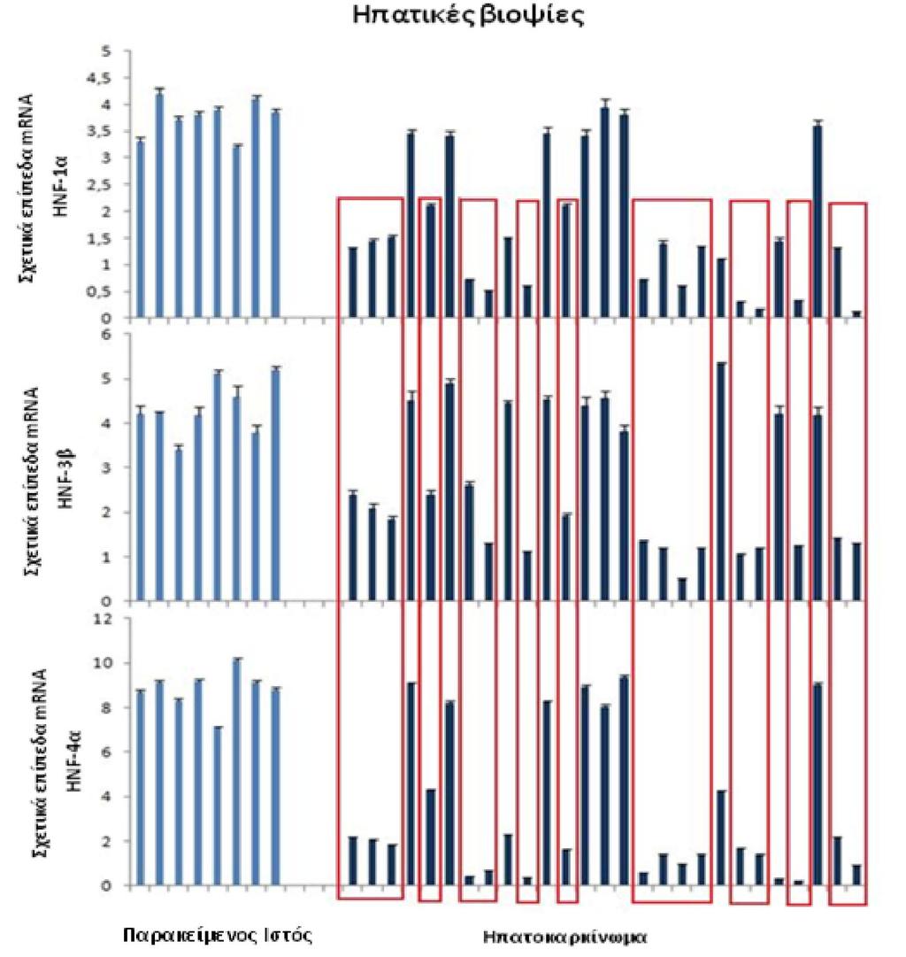 Εικόνα 42: Ανάλυση, με real-time RT-PCR, των επιπέδων έκφρασης των ηπατοειδικών μεταγραφικών παραγόντων, HNF-1α, HNF-3β, HNF-4α, σε 27 δείγματα ανθρώπινων βιοψιών ηπατοκαρκινώματος και 8 δείγματα