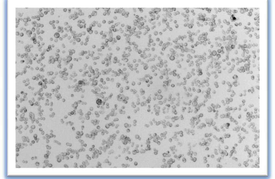 mir-treated κύτταρα (72h) Control κύτταρα (72h) Εικόνα 27: Απεικόνιση του πιάτου που έχει υποστεί