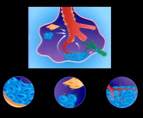 of proliferation of certain tumor cells Inhibition of stromal signaling Inhibition of