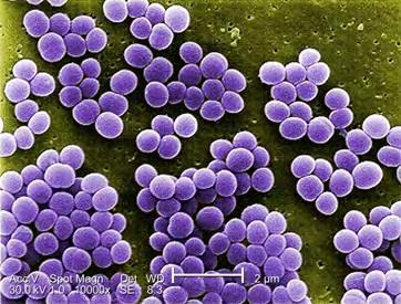 1.3 Staphylococcus aureus (Χρυσίζων Σταφυλόκοκκος): Ο S. aureus ταξινομείται στους θετικούς κατά Gram κόκκους.