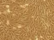 Εικόνα 13: C2C12 κύτταρα σε οπτικό μικροσκόπιο 4.