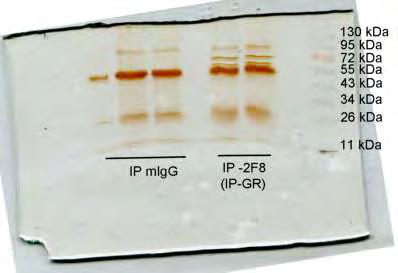 2 Αποτελέσματα χρώσης πηκτής με τη μέθοδο Silver staining του 2 ου πειράματος Η παρακάτω εικόνα αντιπροσωπεύει τα αποτελέσματα της ανίχνευσης πρωτεϊνών με τη μέθοδο Silver staining του 2 ου