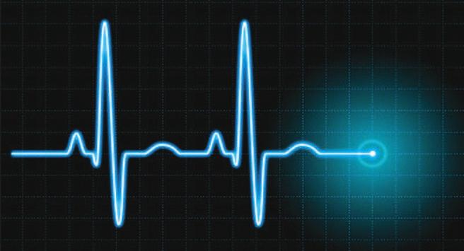 Elektrokardiogram (EKG) ili encefalograf (EKG) su grafički zapisi funkcija srca, odnosno mozga, i već sam pogled na njih stvara intuitivan dojam o pojmu periodičnost.