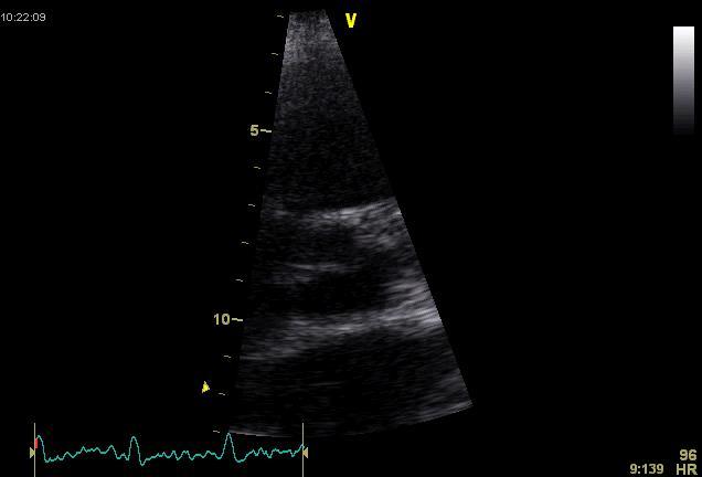 Cardiov Imag 2013