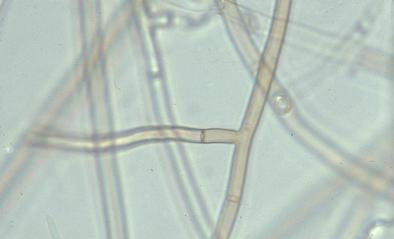 Χαρακτηριστικά μυκηλίου Rhizoctonia solani Κάθετες διακλαδώσεις