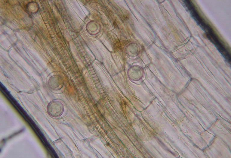 Ωοσπόρια Pythium Ωοσπόρια σε φυτικό ιστό