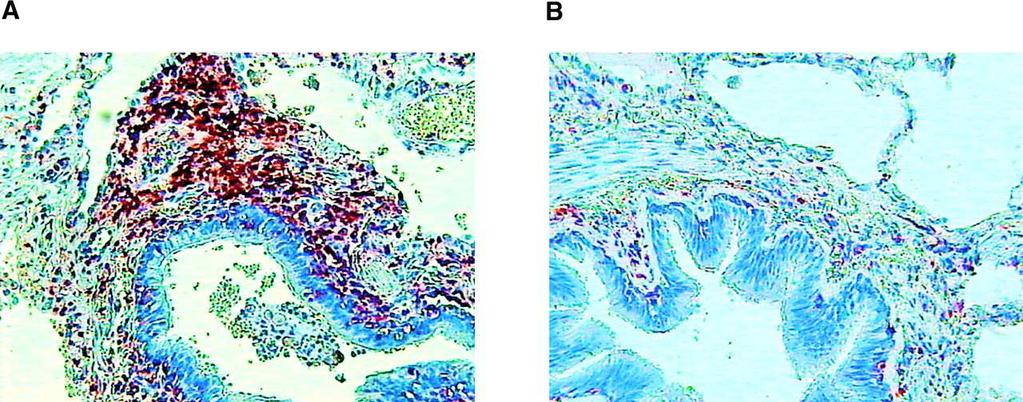 Turato G et al, Saetta M et al