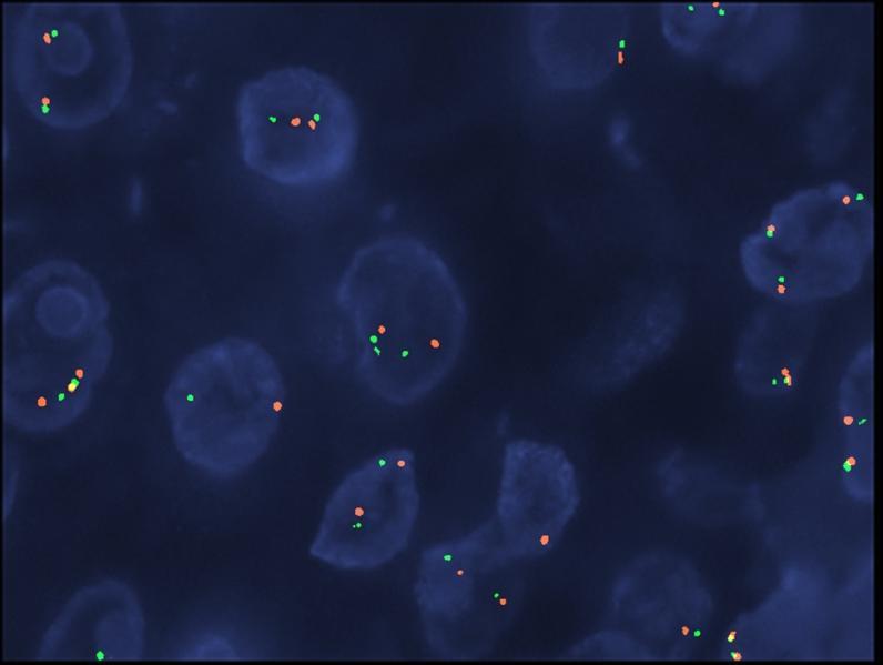 Α. CEP10 PTEN Β. Εικόνα 8.6.