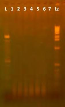 Αποτελέσματα 1. Αποτελέσματα PCR A. DOP-PCR Όπως ήδη αναφέρθηκε, αρχικά πραγματοποιήθηκε η DOP-PCRγια την προενίσχυση, μη ειδικά, ολόκληρου του γονιδιώματος των εντεροϊών.