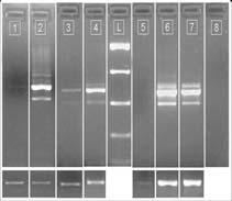 Εργαστηριακές Μέθοδοι DNA ΜΕΤΑΓΡΑΦΗ RNA ΜΕΤΑΦΡΑΣΗ Πρωτεΐνες Εκχύλιση RNA - Λύση & ομογενοποίηση των κυττάρων - Αφαίρεση πρωτεϊνών & DNA - Απομόνωση ώριμων μορίων mrna ΑΑΑΑΑ mrna ΑΑΑΑΑ Σύνθεση cdna -