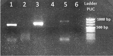 22R Bd13929R 5 -ATTGTACCTTGTGTATCAGGGTTTATC-3 23 ο 23F Cf13500F 5 -ATACTTTAACATTACAAAACTTTAGAC-3 23R Cf14399R 5 -GCTTATGTTTAAGAAGAGATGG-3 24 ο 24F Cc14238F 5 -ACCTTAATAGTAAGAGTGACGG-3 24R Cc14814R 5