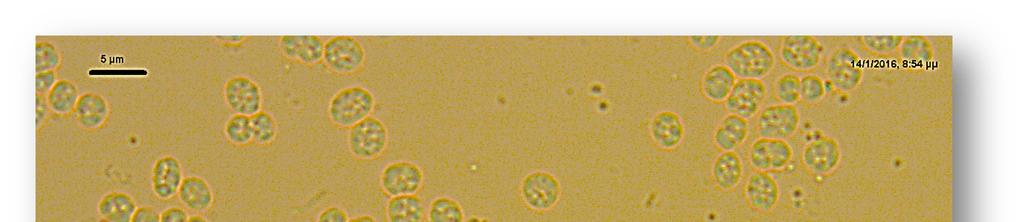 Κεφάλαιο 5ο Παράθεση και σχολιασμός των πειραματικών αποτελεσμάτων Σχήμα 5.27 Εικόνα οπτικού μικροσκοπίου κυτταρικού πληθυσμού στις 22.