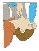 8 Accións para administrar as respiracións 1) Manteña a vía aérea aberta colocando unha man na fronte e dous dedos da outra man na zona ósea do queixo.