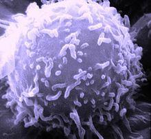 Επίδραση στα καρκινικά κύτταρα Κατά την επαφή τους με την κυτταρική μεμβράνη (λιπαρή επιφάνεια) το