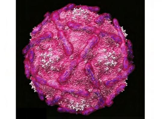 ΜΗΝΙΓΓΙΤΙΔΑ LABORATORY INVESTIGATION OF THE ENTEROVIRAL VP1 GENOMIC REGION AND ASSOCIATION
