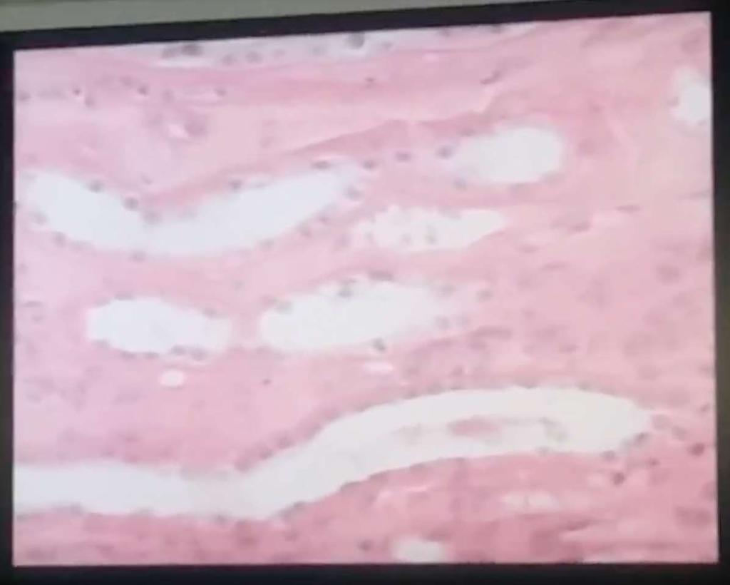 Σωληνάρια που βλέπουμε τα όρια των κυττάρων