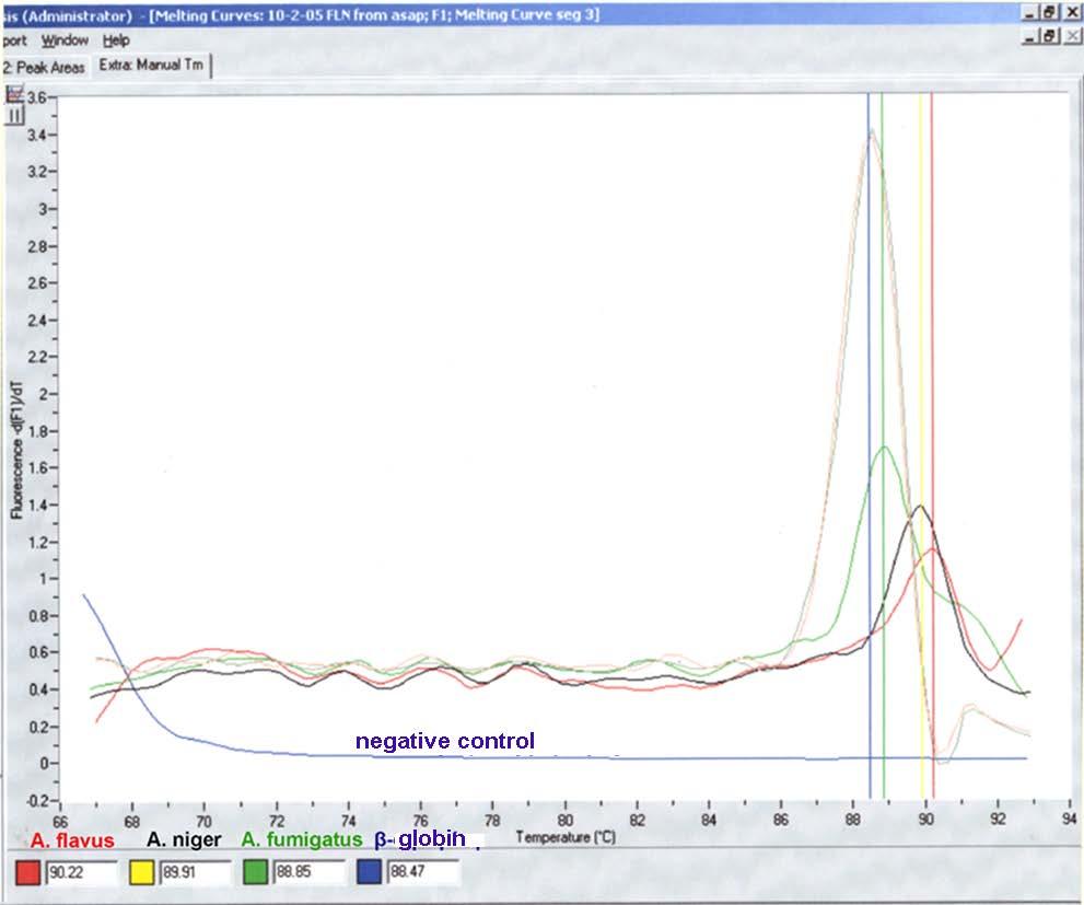 Πολυπλεκτική PCR πραγματικού χρόνου για τρία είδη παθογόνου