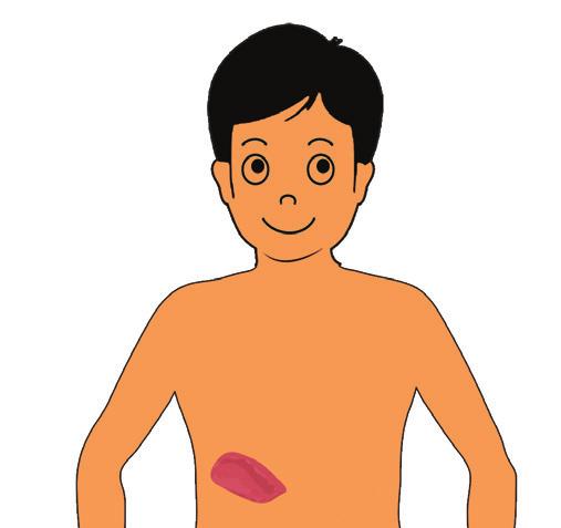 تور م يف اليدين أو القدمني. إنتفاخ يف املعدة: خصوصا إذا كانت املنطقة حساسة للمس.