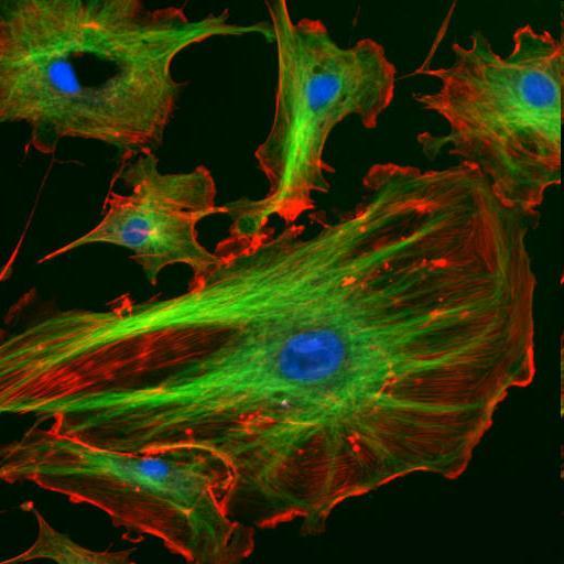 Cytoskeleton Mikrofilamenty aktín