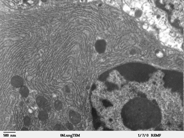 ER Hladké Syntéza lipidov, steroidov glucose-6-phosphatase detoxifikácia Drsné