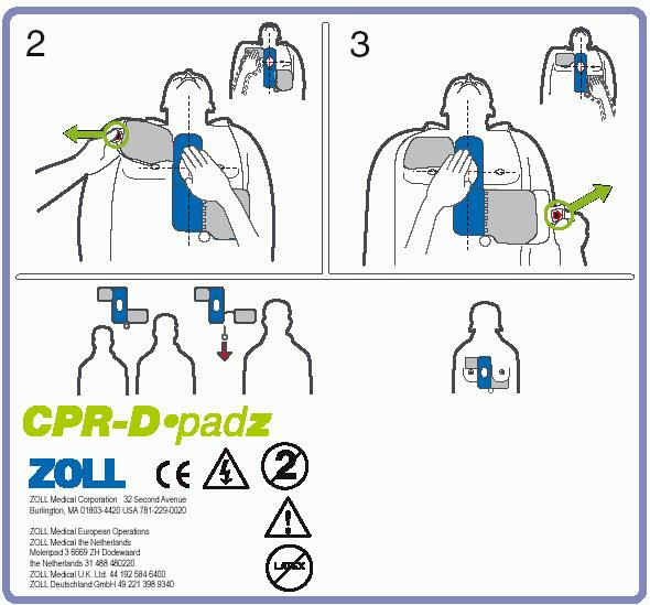 Εφαρμογή του CPR-D-padz Ετοιμάστε τον ασθενή πριν τοποθετήσετε τα ηλεκτρόδια. ΠΡΟΕΙΔΟΠΟΙΗΣΗ! Η λειτουργία παρακολούθησης KAPΠA δεν προορίζεται για χρήση σε ασθενείς κάτω 8 έτων.