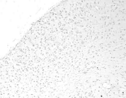 Μικροφωτογραφίες στις οποίες φαίνεται η τοπογραφική κατανοµή των TUNEL+ κυττάρων στον dlgn επίµυος που είχε υποστεί αφαίρεση του βολβού του οφθαλµού τη Μ14 και θυσιάστηκε τη ΜΒ1(A), συγκριτικά µε