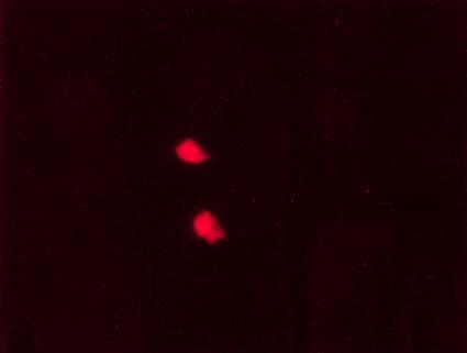 TUNEL+ κύτταρα σεσηµασµένα µε το αντίσωµα εναντίον της GFAP εντοπίστηκαν σε µικρό αριθµό και ταυτοποιήθηκαν ως αστροκύτταρα (Εικόνα 12). Α Β Εικόνα 11.
