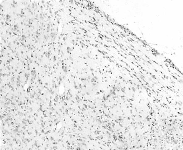 Μικροφωτογραφίες στις οποίες φαίνεται η τοπογραφική κατανοµή των TUNEL+ κυττάρων στον dlgn επιµύων που είχαν