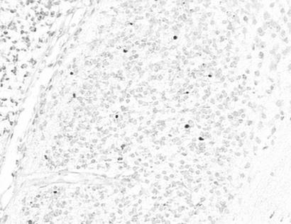 (Β) στον dlgn επίµυος που είχε υποστεί αφαίρεση του βολβού του οφθαλµού τη Μ0 και θυσιάστηκε τη ΜΒ1. Το βέλος στη Β δείχνει το αποπτωτικό κύτταρο που απεικονίζεται σε µεγαλύτερη µεγέθυνση στο ένθετο.