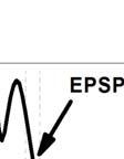 ανερχόμενης φάσης του (θετικήή στην πυραμιδική στοιβάδα και αρνητική στην ακτινωτή), κλίση του EPSP (mv/ms).