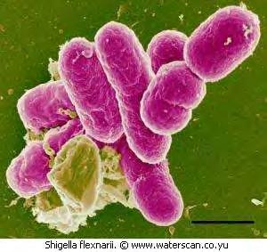 Εικόνα 9. Σιγγέλα E. coli Ανήκει στην ομάδα των κολοβακτηριοειδών, είναι ένας Gram-αρνητικός,αερόβιος, μησπορογόνος, οξειδάση αρνητικός, ραβδόμορφος μικροοργανισμός.