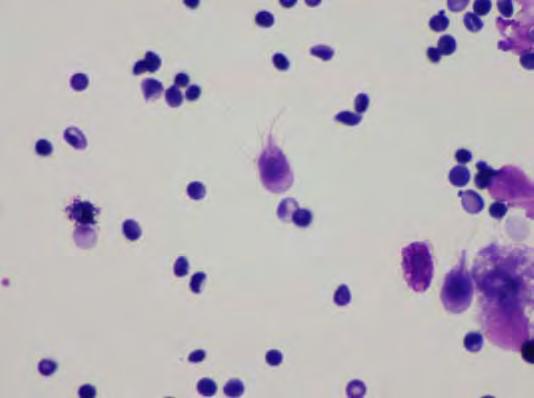 Giardia Η Giardia lamblia είναι πρωτοζωικό παράσιτο με τροφοζωίτες μήκους 9 ως 20 μm και πλάτους 5 ως 15 μm έχοντας την εμφάνιση χαμογελαστού προσώπου.