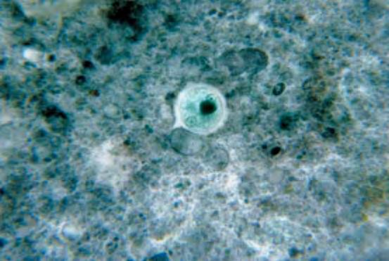 Entamoeba histolytica H Entamoeba histοlytica είναι εντερικό παράσιτο με τροφοζωίτες μεγέθους 20 ως 30 μm.