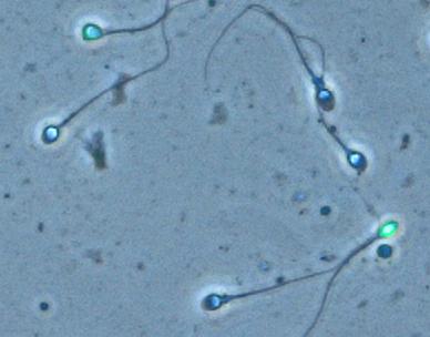 TUNEL (Terminal deoxyncleotidyl