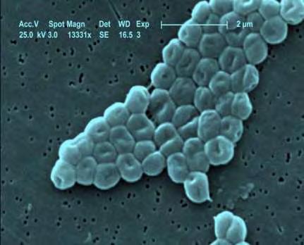 1.2 Βακτήρια κλινικής σημασίας Α) Το Acinetobacter baumannii είναι ένα είδος παθογόνου βακτηρίου, ως gramαρνητικό βακτήριο. Το βακτήριο αυτό είναι ανθεκτικό στα περισσότερα αντιβοτικά.