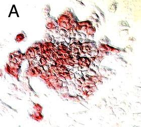The role of sulphonylureas Some studies