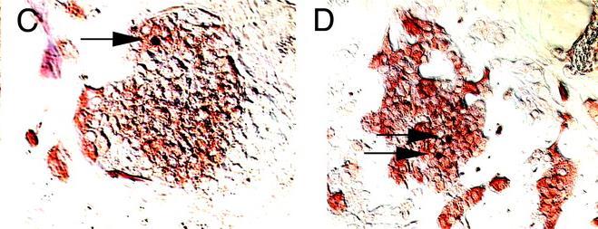 sulphonylurea-induced beta-cell