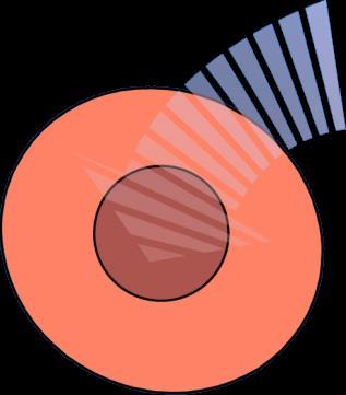 Genetic susceptibility, obesity, Western