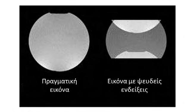 θόρυβος, ενώ εάν η κωδικοποίηση είναι μικρότερη από την ταχύτητα κορυφής τότε δημιουργούνται ψευδενδείξεις (aliasing or wrap) στις μετρήσεις [29].