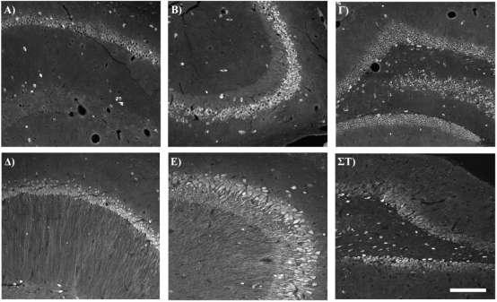 Εικόνα 32: Νευρώνες με θετική ανοσοδραστικότητα στο GABA στη ραχιαία μοίρα ιπποκάμπου μονιμοποιημένου με perfusion (A-Γ) και