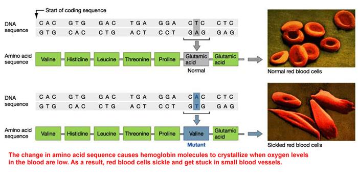 Mutácia Glu6Val (E6V) v beta-globínovom géne a kosáčiková anémia Normálne erytrocyty