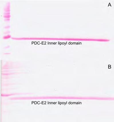 3.1.2 Ανοσοαποτύπωση Η πρωτεΐνη PDC-E2 μετά τη μεταφορά της στην PVDF μεμβράνη βαφόταν με χρωστική Ponceau-S με ικανοποιητική μεταφορά της πρωτεΐνης όπως φαίνεται και στην Εικόνα 8. Εικόνα 8. Η 16.