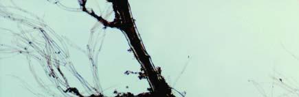 sphaerocarpa