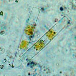 Dinoflagellates 1. Achnathes sp. 1. Ceratium furca 2. Chetocerοs decipiens 2. Ceratium sp. 3. Chetocerοs sp. 3. Cyrosigma sp.