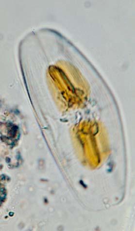 Nitzschia closterium 7. Oxytoxum sp. 8. Nitzschia serriata 8. Prorocentrum sp. 9. Pleurosigma sp. 9. Prorocentrum micans 10.